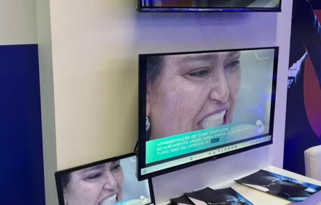 iDenture: Líder em Próteses Dentárias 3D